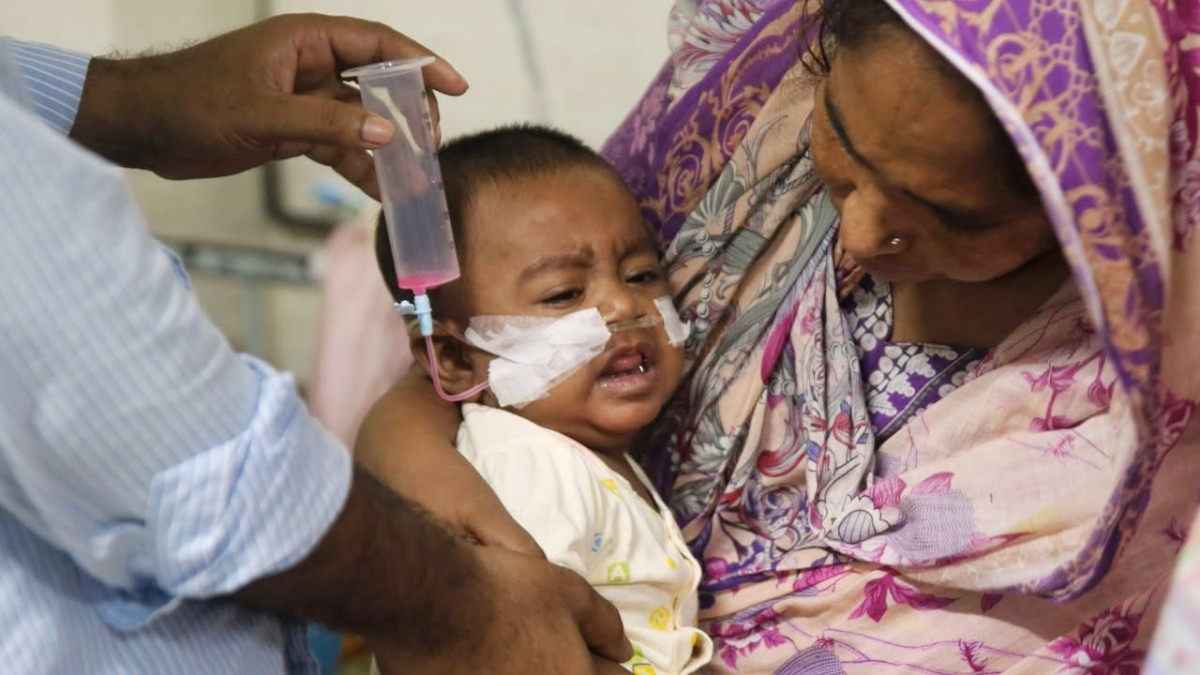 হাম, শিশু