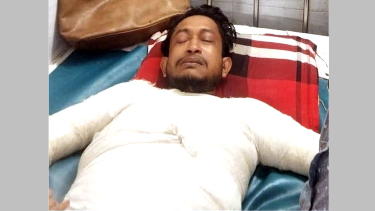 হাসপাতালে চিকিৎসাধীন আগুনে দগ্ধ সাব্বির মোল্লা