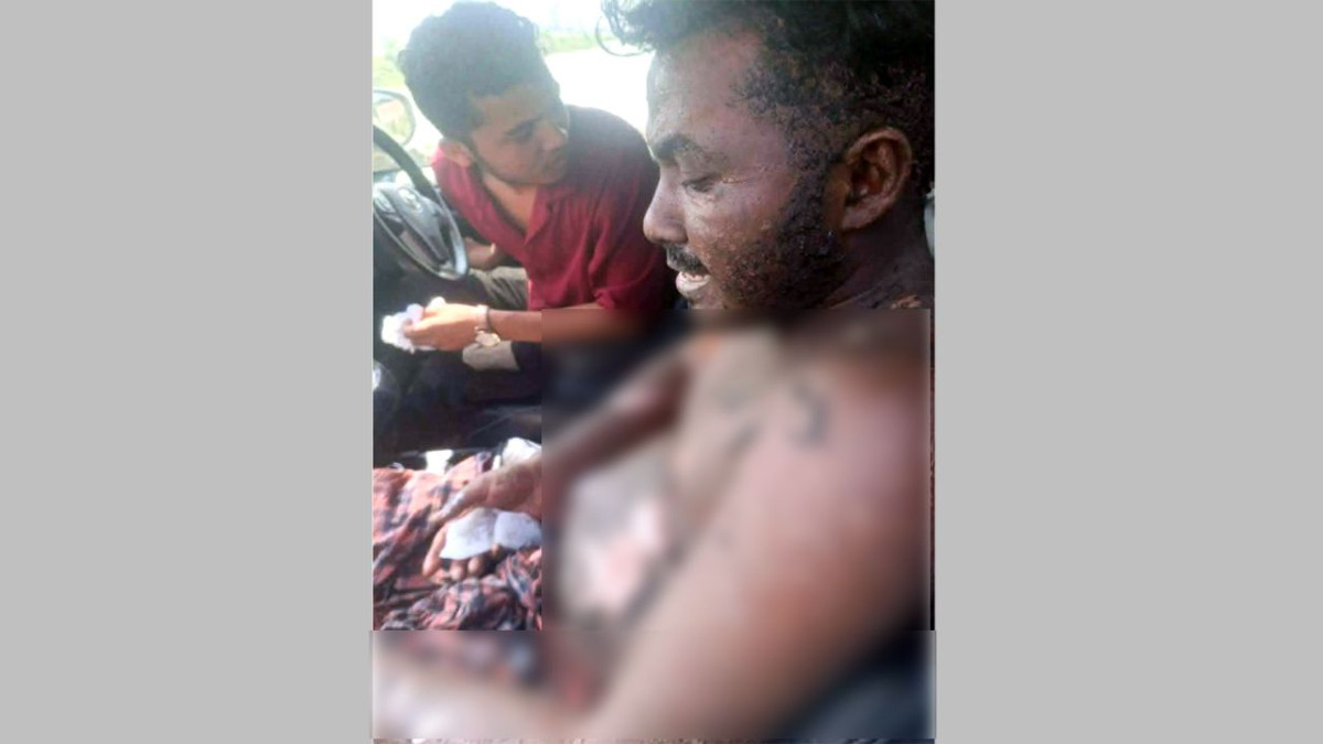 আহত এক শ্রমিক